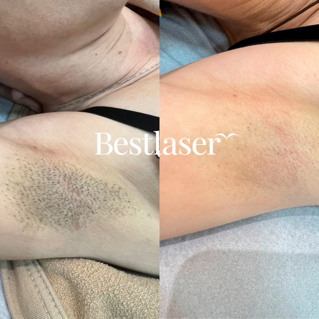 ARMPITS-2-1.png