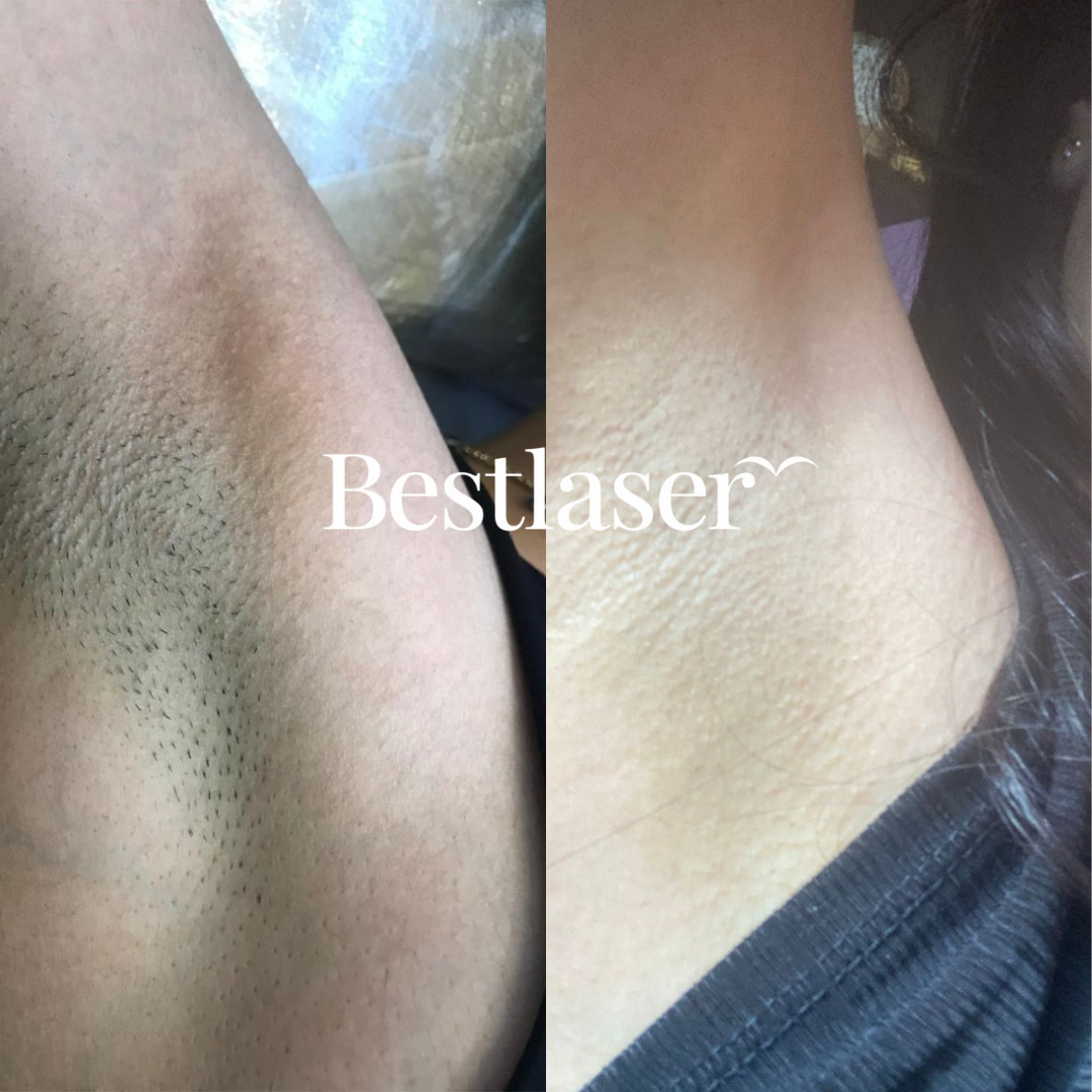 ARMPITS-3-1.png